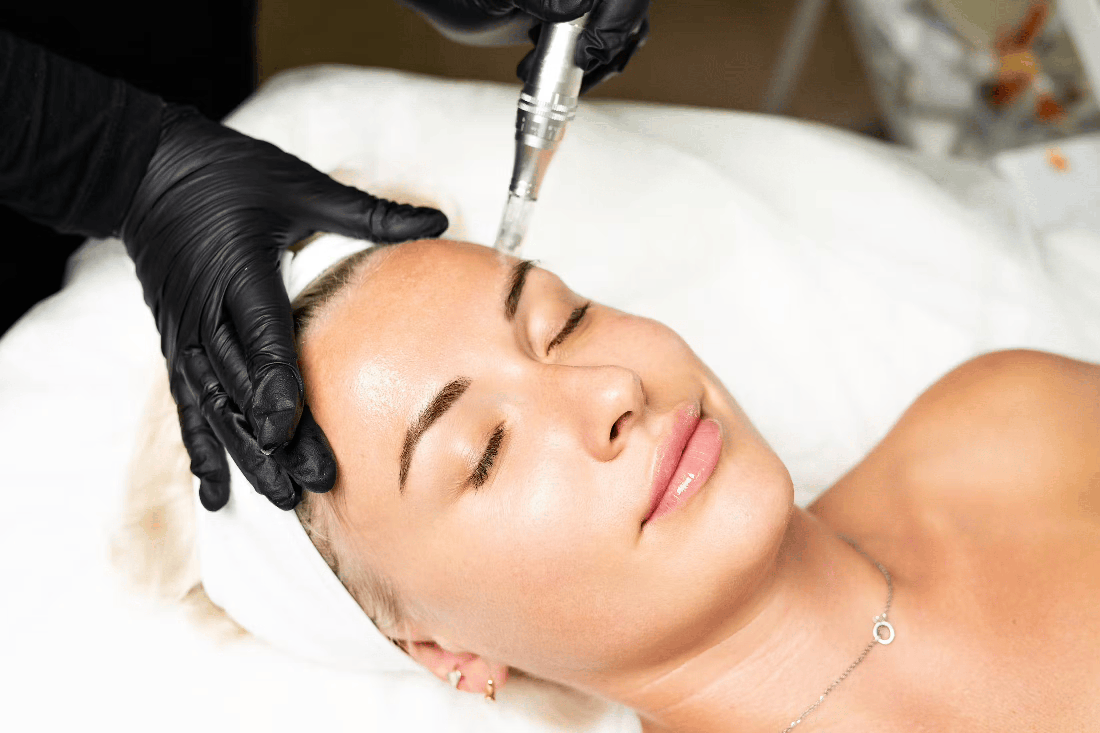 Skin Needling Black Gloves