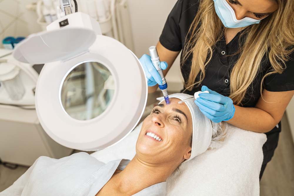 microneedling for anti-ageing